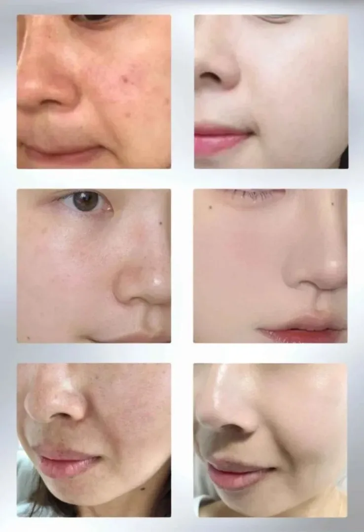 Foto Before-After Wajah dan Tubuh Paling Dramatis